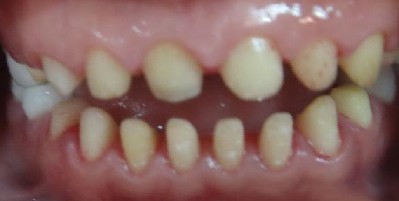 ޸