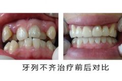 圣贝美颜正畸，让你告别牙列不齐