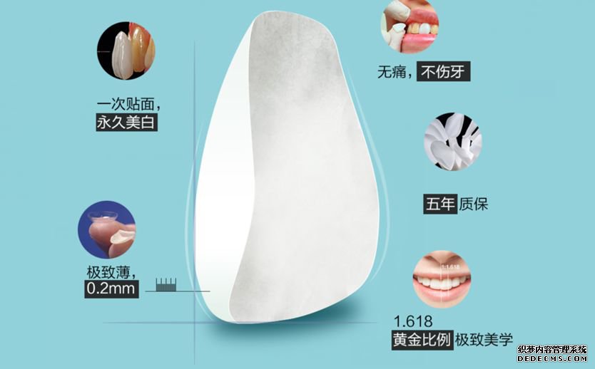 牙齿贴面..jpg