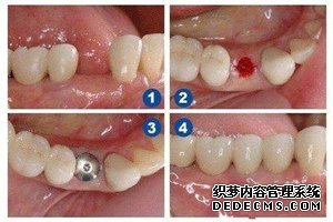 空姐种牙.._副本.jpg