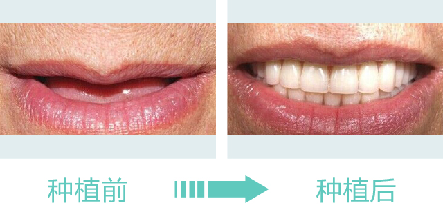 种植3.jpg