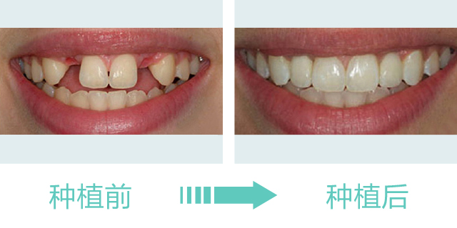 种植1.jpg