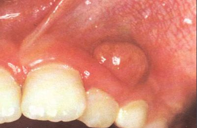 5b17377fda9a3.jpg