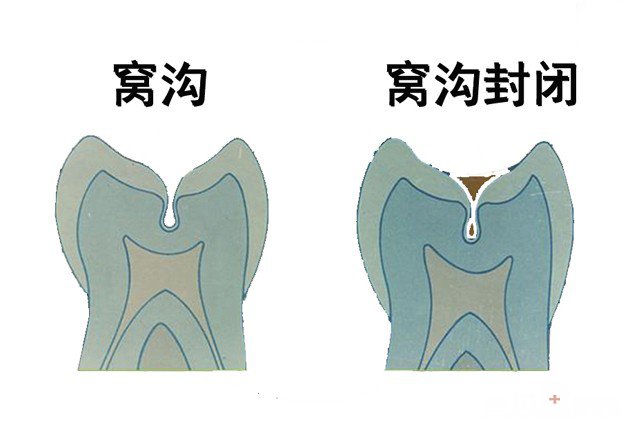 ff9a7787-284e-44e6-a714-81f94f006d857781.jpg