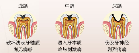 1-16031QH6102A.png