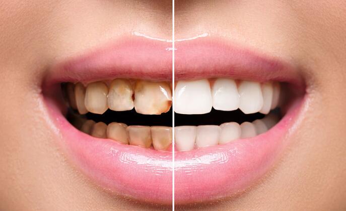 1545468844996466.jpg QQ图片20180629094738.jpg