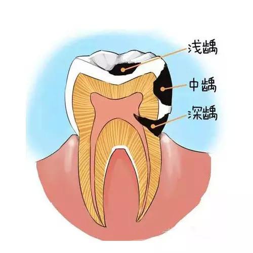 补牙..jpg