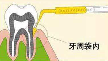 下载.jpg